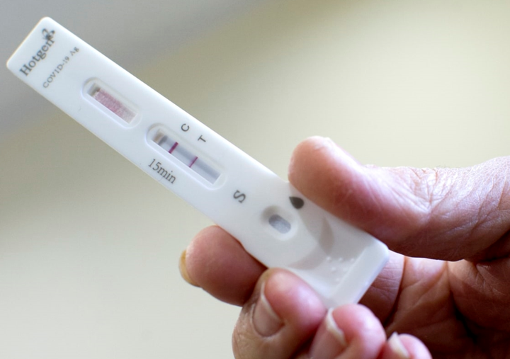 Vạch kit test COVID-19 lúc đậm lúc mờ thể hiện điều gì? - 1