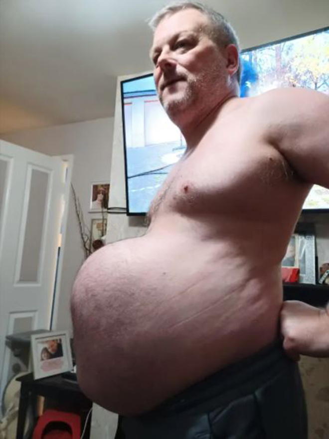 Người đàn ông 'mang bụng bầu 9 tháng' chỉ vì dịch COVID-19 - 1