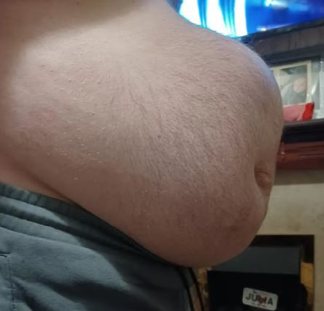 Người đàn ông 'mang bụng bầu 9 tháng' chỉ vì dịch COVID-19 - 2