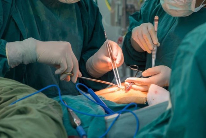 Tìm nguyên nhân người phụ nữ tử vong do hút mỡ bụng - 1