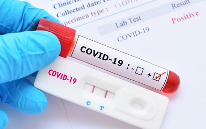 Chính phủ gia hạn thời gian thanh tra mua sắm kit xét nghiệm, vaccine COVID-19 - 1