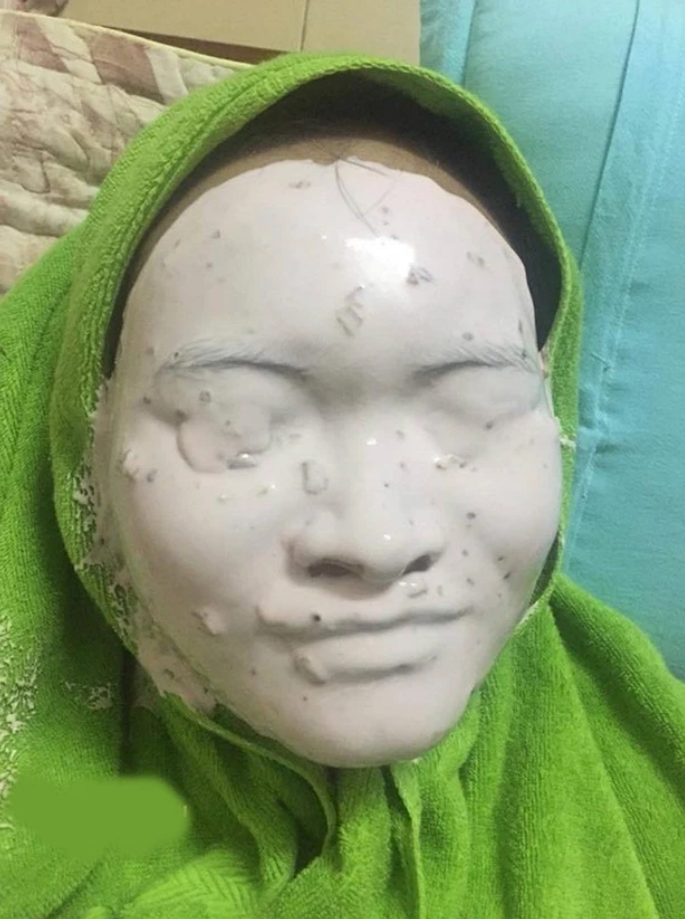 Hết hồn với cách làm đẹp dễ khiến người nhìn mất ngủ của các chị em - 5