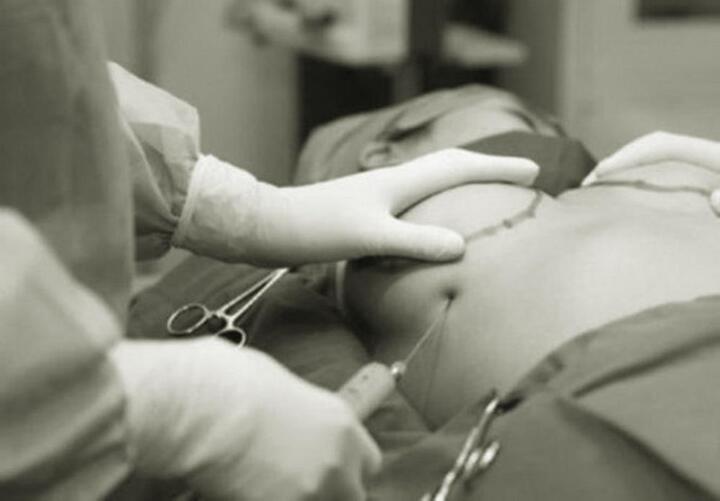 Những biến chứng có thể gặp khi phẫu thuật nâng ngực - 1