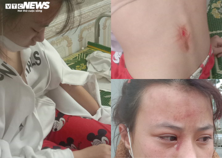 Hà Tĩnh: Khởi tố gã hàng xóm đánh nữ sinh lớp 10 chấn động não - 1