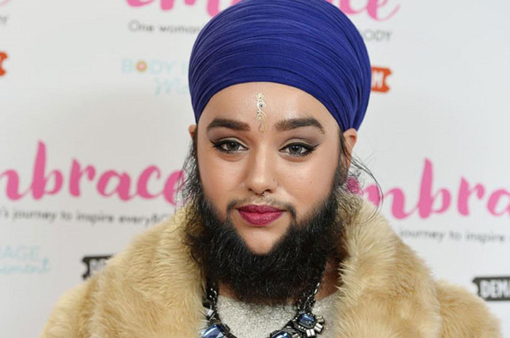 Cô gái bị bắt nạt, suýt tự tử vì bộ râu bỗng thành người mẫu vạn người theo dõi - 1