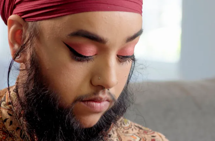 Cô gái bị bắt nạt, suýt tự tử vì bộ râu bỗng thành người mẫu vạn người theo dõi - 2