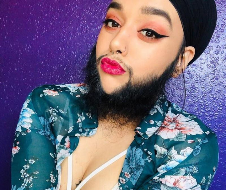 Cô gái bị bắt nạt, suýt tự tử vì bộ râu bỗng thành người mẫu vạn người theo dõi - 5