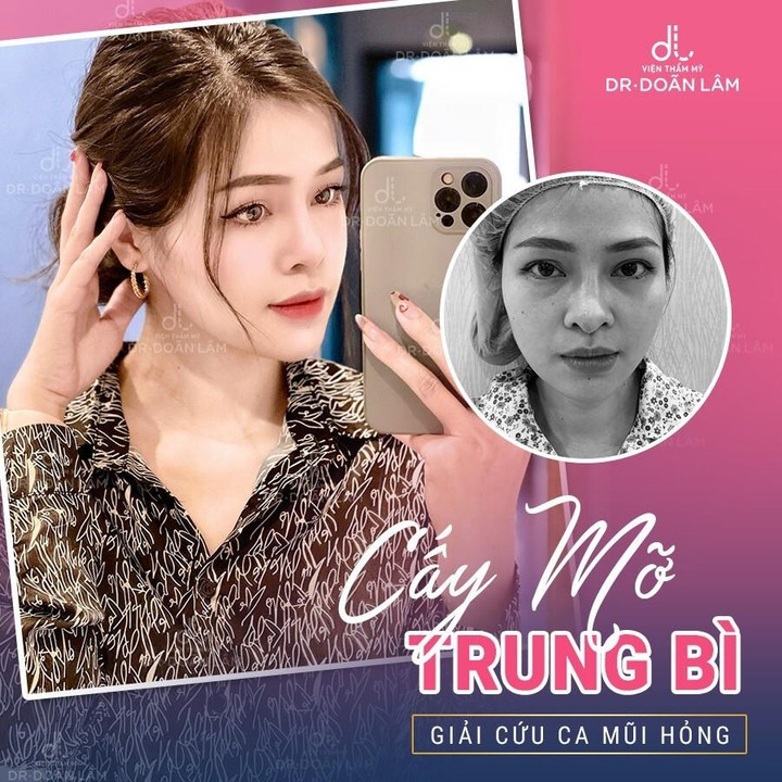 Dr Doãn Lâm: Chuyên gia 'giải cứu' thành công những ca nâng mũi hỏng - 5