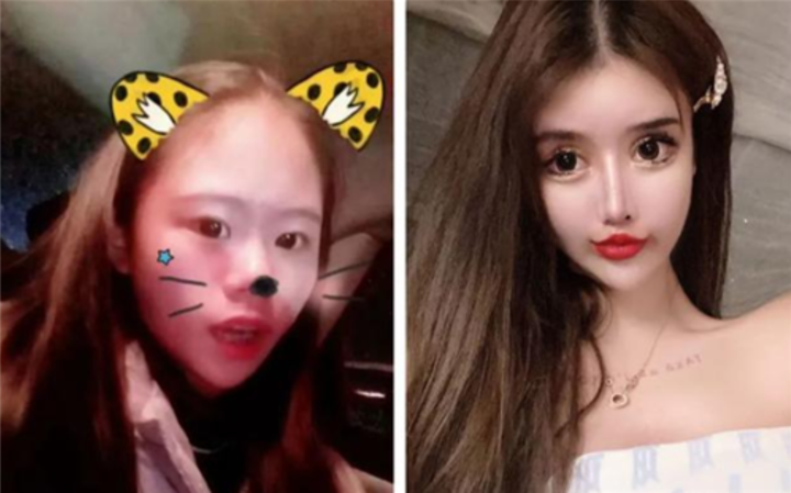 Bi kịch cô bé 13 tuổi phẫu thuật thẩm mỹ, hơn 100 lần dao kéo để được đối xử tốt - 3