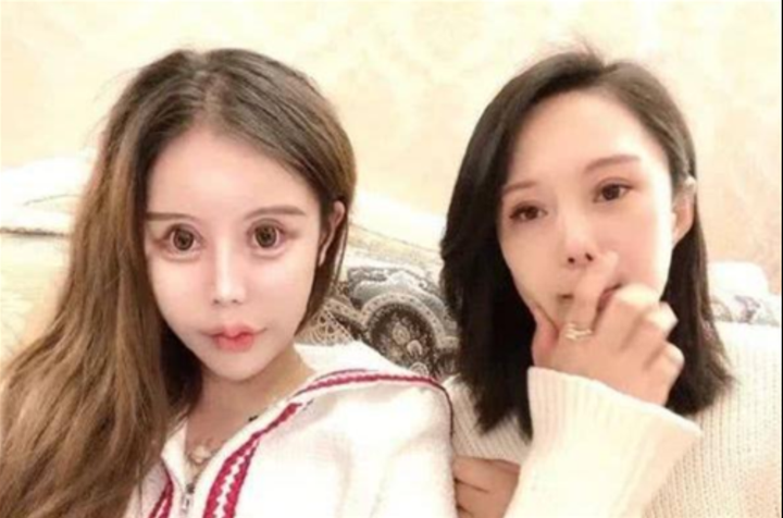 Bi kịch cô bé 13 tuổi phẫu thuật thẩm mỹ, hơn 100 lần dao kéo để được đối xử tốt - 5