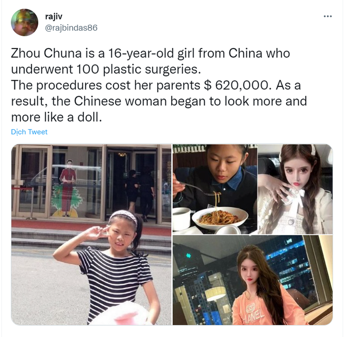 Bi kịch cô bé 13 tuổi phẫu thuật thẩm mỹ, hơn 100 lần dao kéo để được đối xử tốt - 1