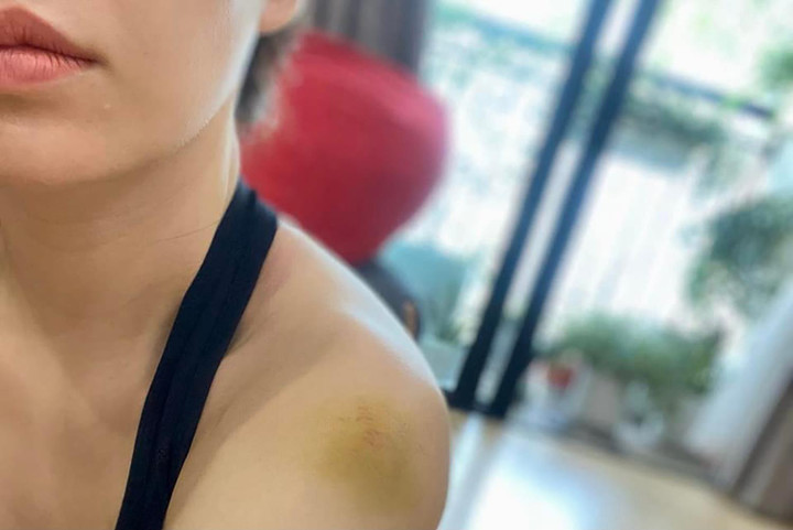 Đan Lê bầm dập vì cảnh bị đánh trong 'Anh có phải đàn ông không?' - 3