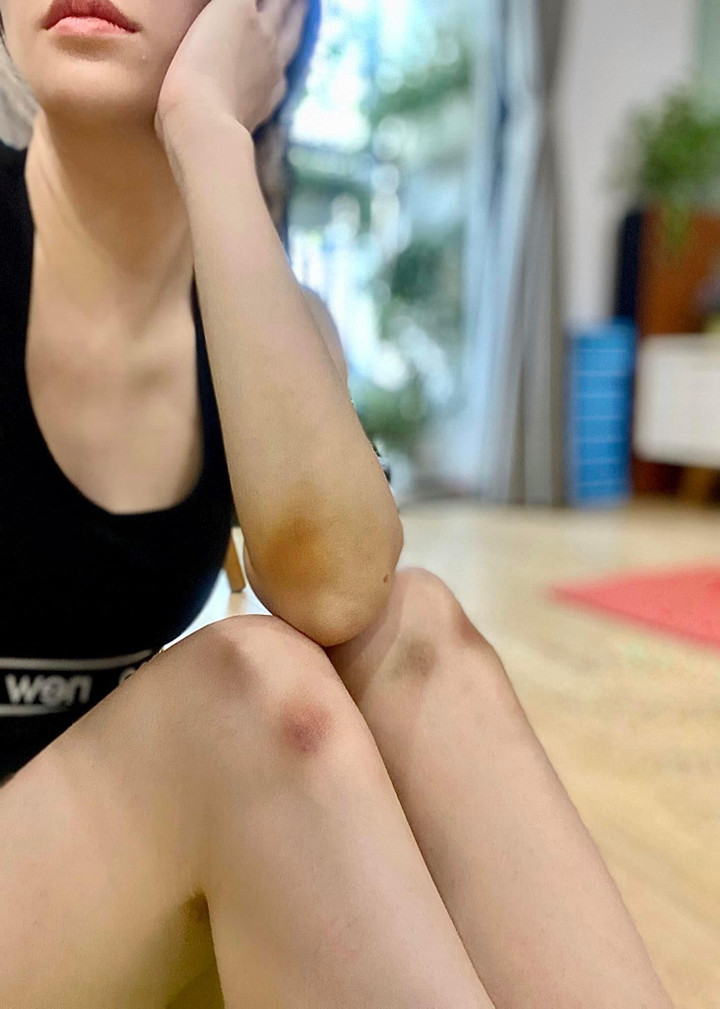 Đan Lê bầm dập vì cảnh bị đánh trong 'Anh có phải đàn ông không?' - 2