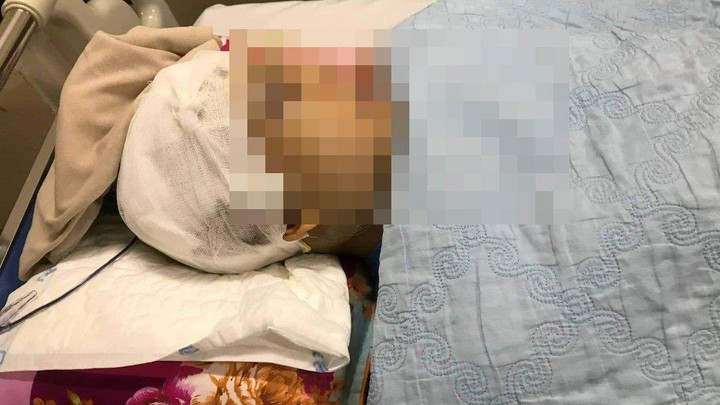 Phó Chủ tịch UBND xã ở Hải Dương bị đánh trọng thương khi làm nhiệm vụ - 1