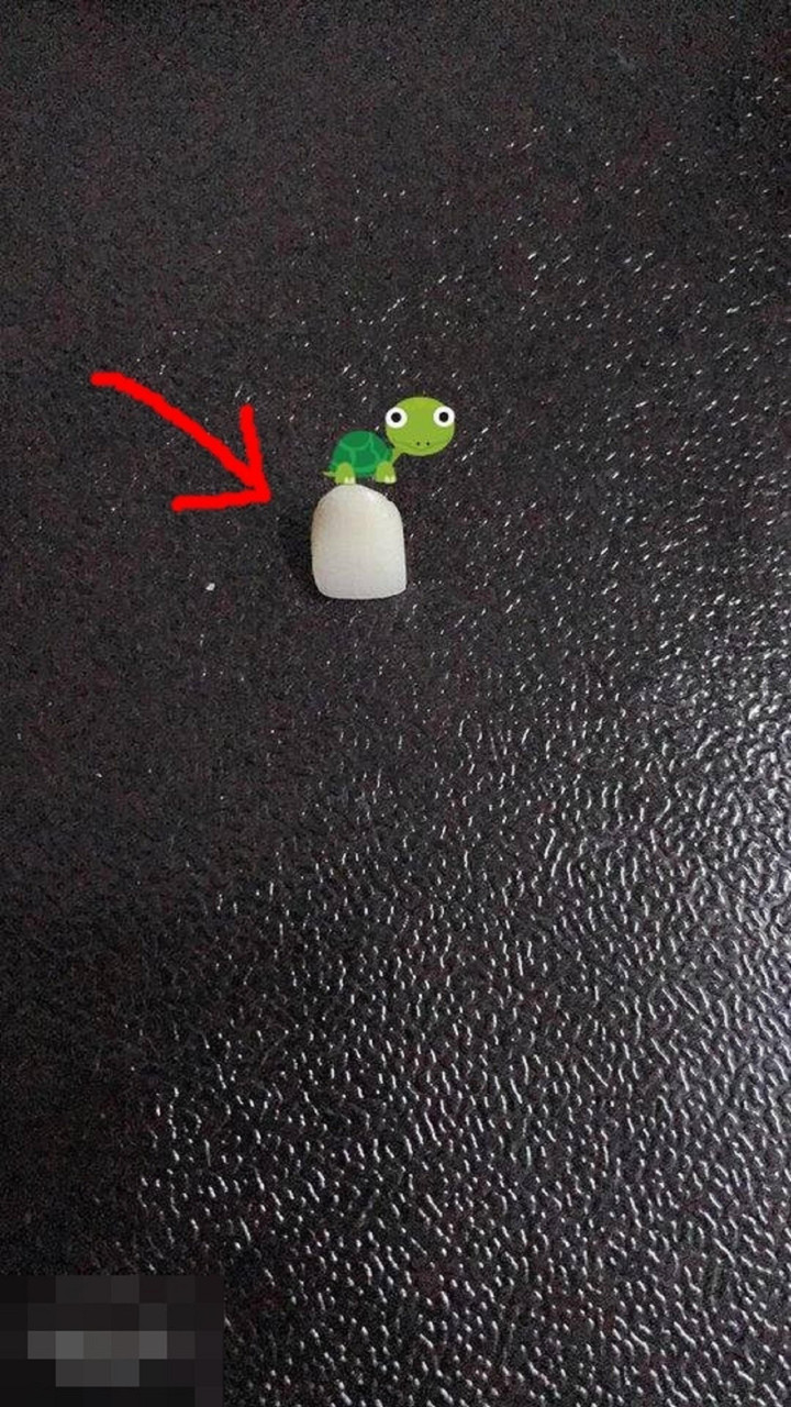 Cô gái gãy mất răng vì chân gà, đọc đến bình luận của dân mạng còn hết hồn hơn - 3