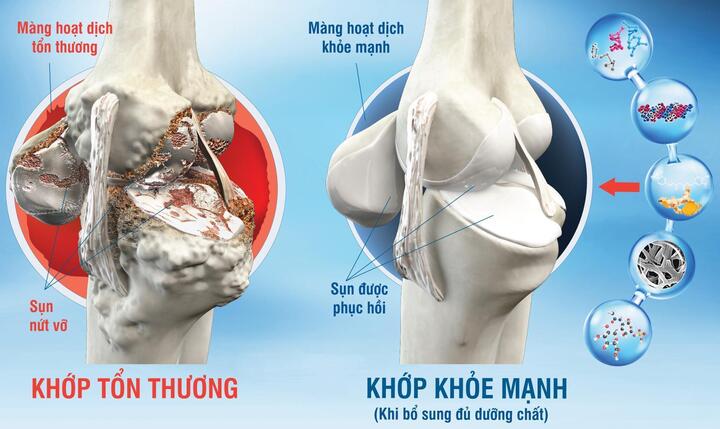 Xương khớp có thể 'già' sớm ở tuổi 30 - 2