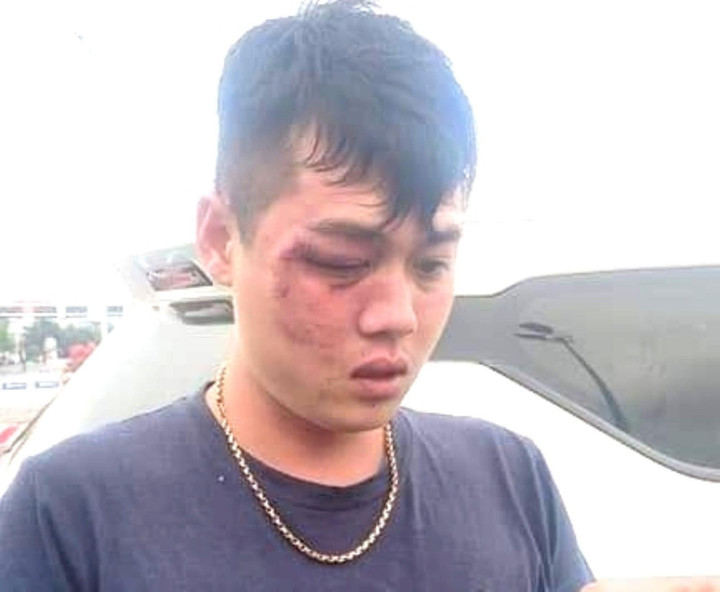 Tạm giữ người chạy ô tô đánh tài xế Grab gục giữa đường phố Đà Nẵng - 1