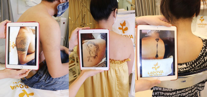 Viện thẩm mỹ Ladova nổi bật với dịch vụ 'Xóa hình xăm không sẹo' - 3