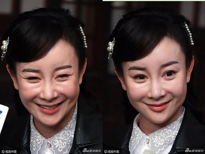 ‘Thần tiên tỷ tỷ’ Cbiz mất cả sự nghiệp vì giật chồng, mặt biến dạng hậu dao kéo - 5