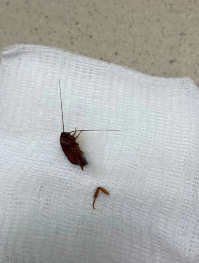 Đang ngủ bỗng thấy đau tai, cô gái kinh hãi khi thấy ‘vật lạ’ lòi ra - 3