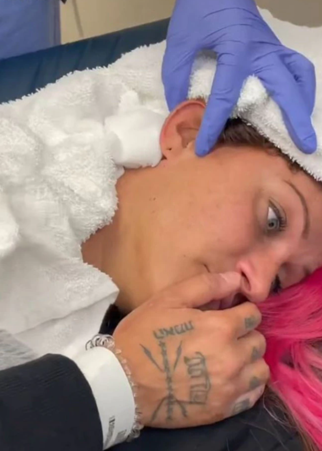 Đang ngủ bỗng thấy đau tai, cô gái kinh hãi khi thấy ‘vật lạ’ lòi ra - 1