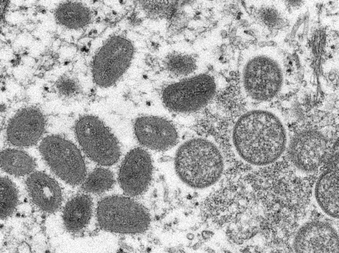 Bệnh đậu mùa khỉ lây lan qua những đường nào? - 2