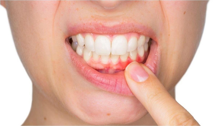 5 dấu hiệu trên mặt cảnh báo sức khỏe lá lách, dạ dày đang xấu đi từng ngày - 2