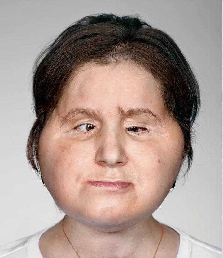 9x bị hư toàn mặt vì sai lầm tuổi 18 và hành trình tìm lại dung mạo đầy xúc động - 4