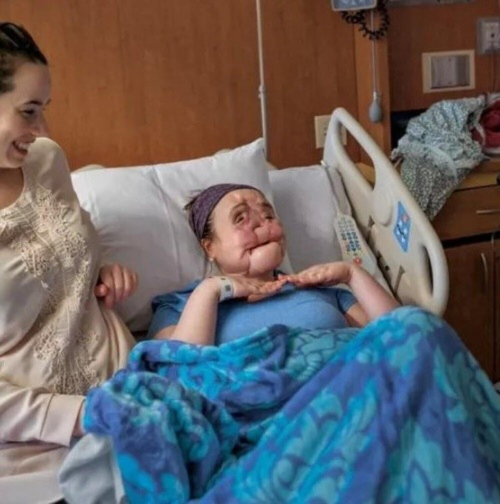 9x bị hư toàn mặt vì sai lầm tuổi 18 và hành trình tìm lại dung mạo đầy xúc động - 3