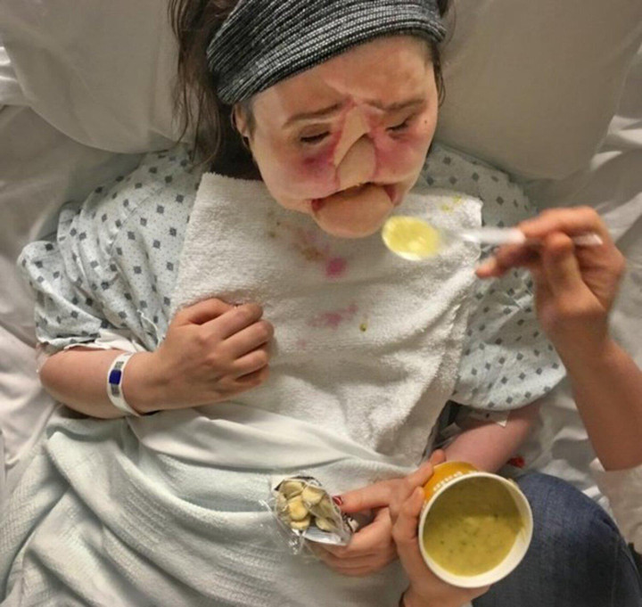 9x bị hư toàn mặt vì sai lầm tuổi 18 và hành trình tìm lại dung mạo đầy xúc động - 2