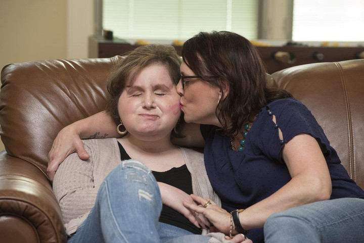 9x bị hư toàn mặt vì sai lầm tuổi 18 và hành trình tìm lại dung mạo đầy xúc động - 6