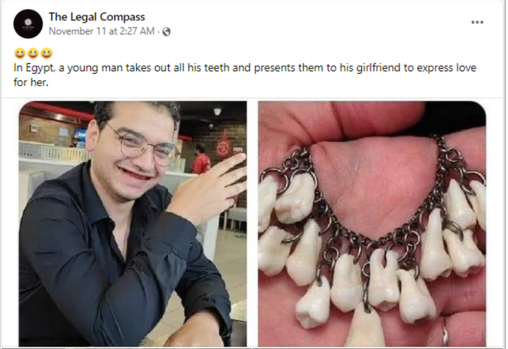 Anh chàng nhổ răng làm vòng tặng bạn gái để bày tỏ tình cảm và sự thật ngã ngửa - 1