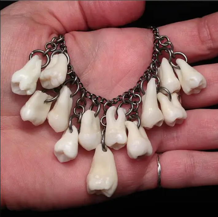 Anh chàng nhổ răng làm vòng tặng bạn gái để bày tỏ tình cảm và sự thật ngã ngửa - 3