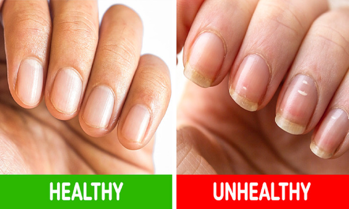 8 dấu hiệu trên cơ thể cảnh báo sức khỏe đang có vấn đề - 2