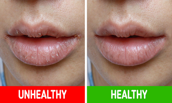 8 dấu hiệu trên cơ thể cảnh báo sức khỏe đang có vấn đề - 3