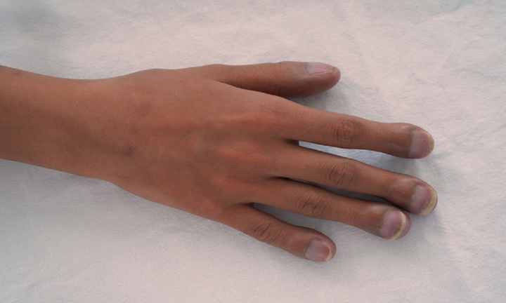 8 dấu hiệu trên cơ thể cảnh báo sức khỏe đang có vấn đề - 4