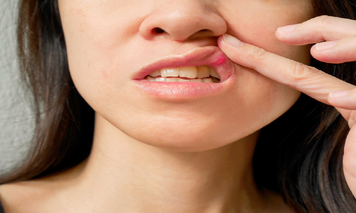 8 dấu hiệu trên cơ thể cảnh báo sức khỏe đang có vấn đề - 5