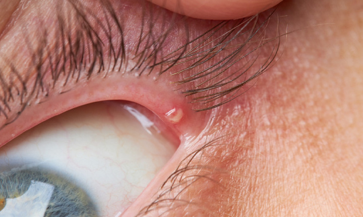 8 dấu hiệu trên cơ thể cảnh báo sức khỏe đang có vấn đề - 6