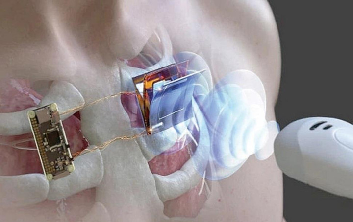 Sạc thiết bị điện tử từ xa bằng sóng siêu âm - 1