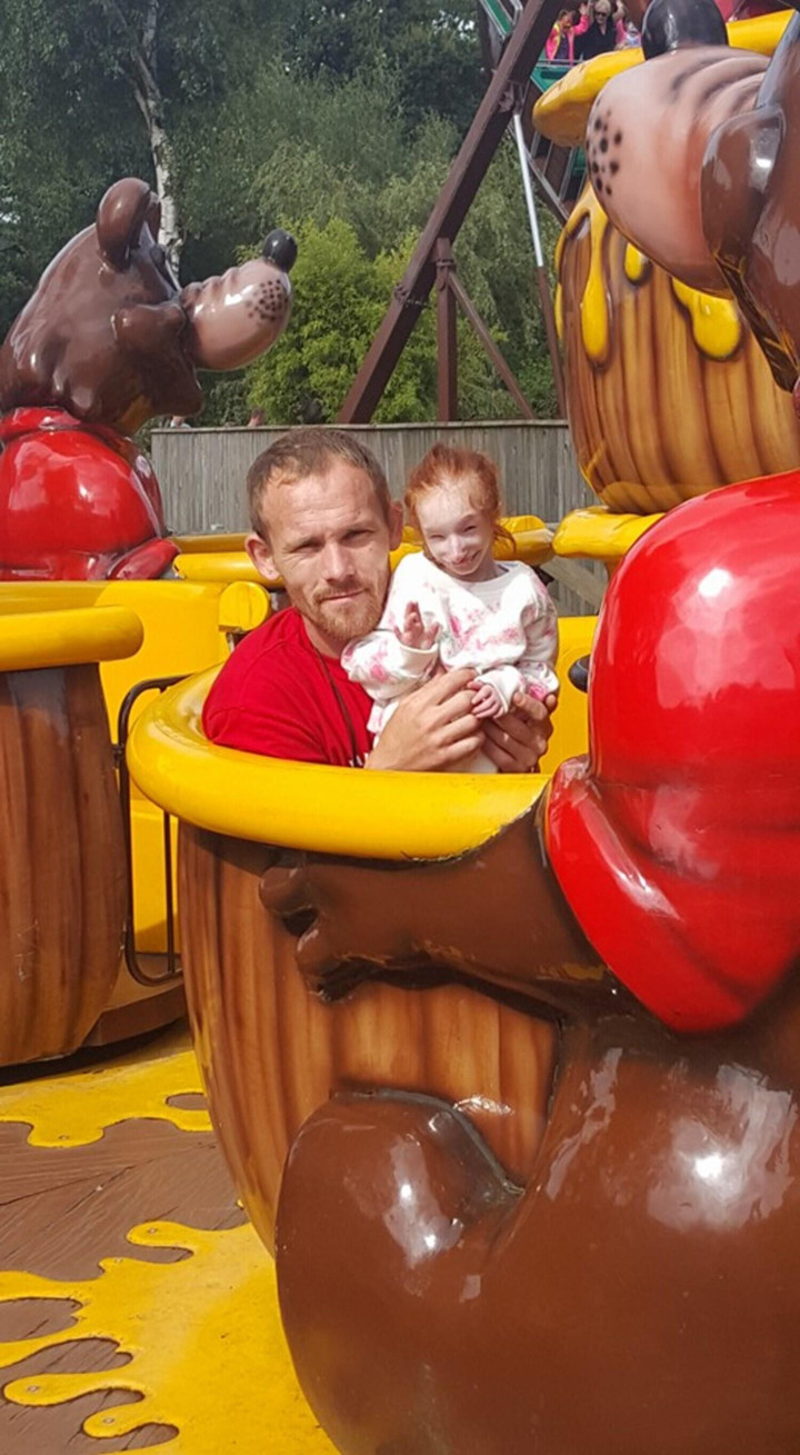 Bé gái nhỏ nhất thế giới kiên cường vượt qua dự đoán ‘không thể sống quá 1 tuổi’ - 8