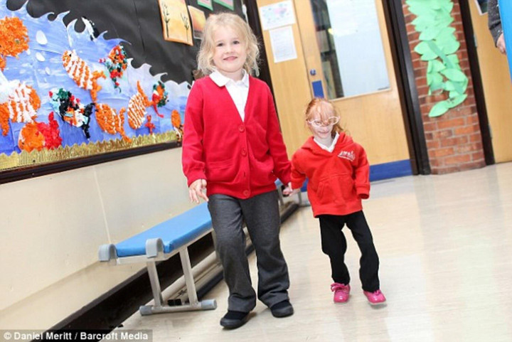 Bé gái nhỏ nhất thế giới kiên cường vượt qua dự đoán ‘không thể sống quá 1 tuổi’ - 3