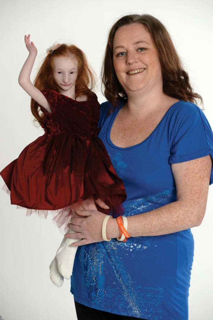 Bé gái nhỏ nhất thế giới kiên cường vượt qua dự đoán ‘không thể sống quá 1 tuổi’ - 7