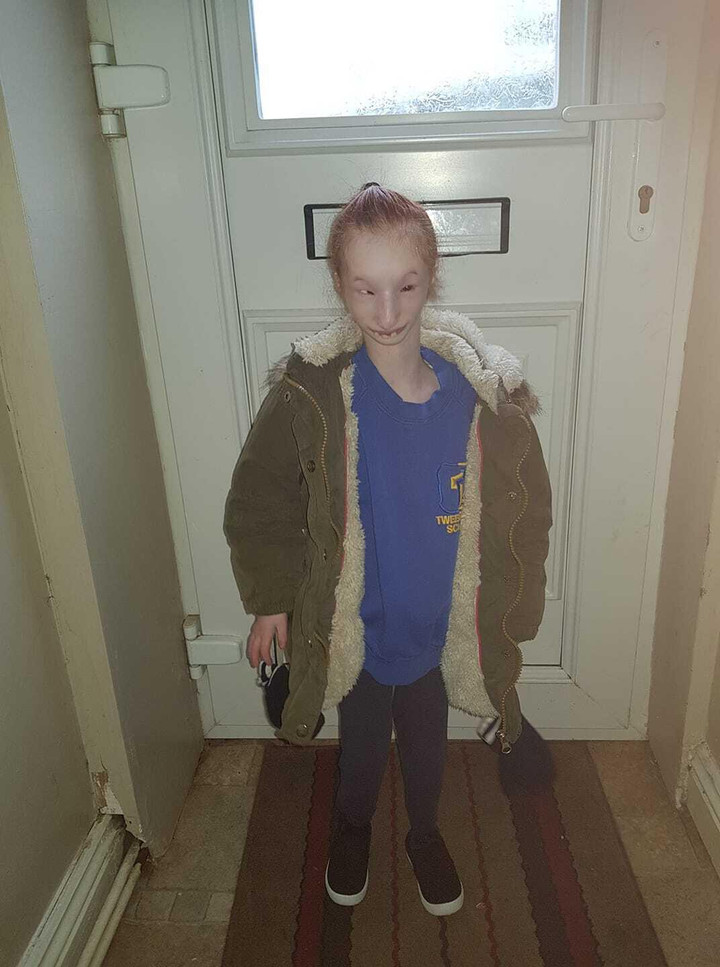 Bé gái nhỏ nhất thế giới kiên cường vượt qua dự đoán ‘không thể sống quá 1 tuổi’ - 9