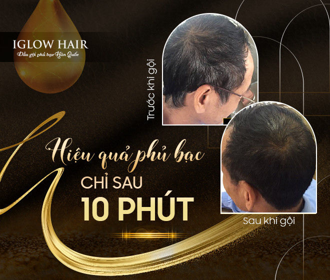 Vì sao sản phẩm phủ bạc Iglow Hair được nhiều người tin dùng? - 2