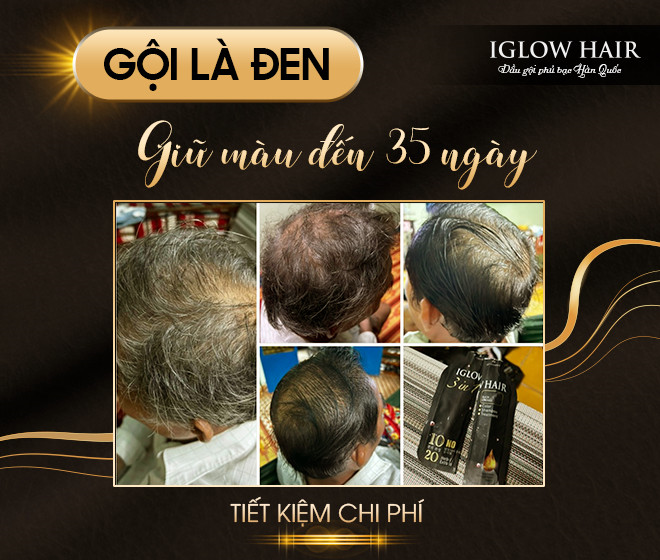 Vì sao sản phẩm phủ bạc Iglow Hair được nhiều người tin dùng? - 3