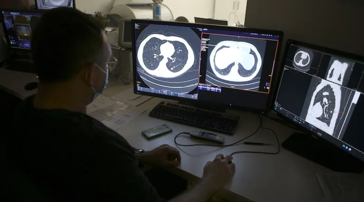 Thử nghiệm thuốc chữa ung thư, bệnh nhân vỡ oà vì thoát 'cửa tử' - 2