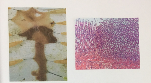 Bình Vị Thái Minh đã được Đại học Y Hà Nội chứng minh hiệu quả - 5