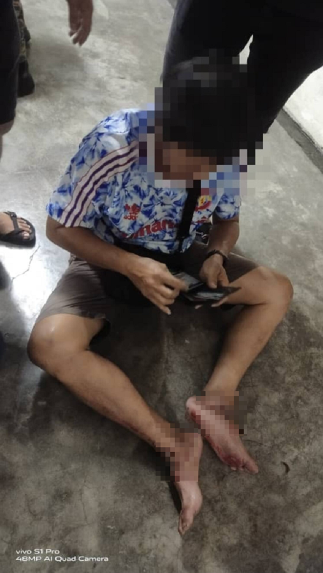 Rùng mình vị khách bị kẹt chân giữa thang máy, camera tiết lộ sự tình không ngờ - 4