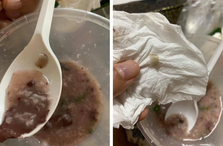 Thực khách số nhọ 'khóc thét' phát hiện những thứ không tưởng lẫn vào đồ ăn - 10