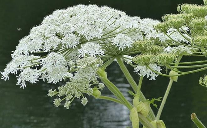 Cây 'sứ giả địa ngục' khiến bé trai bỏng mặt chỉ sau cú chạm nhẹ - 2